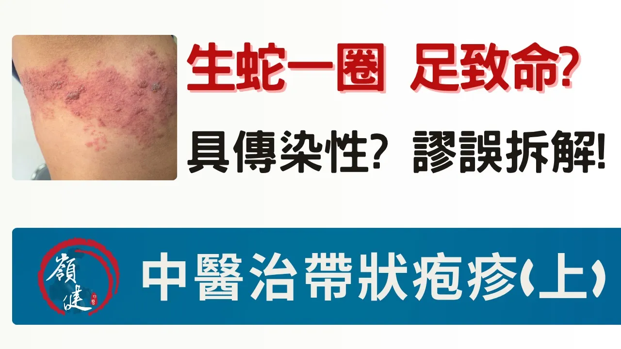 生蛇一圈，足致命